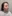 Soprano Titanium laser lifting (Alma trio-wavelength diode laser skin tightening) — Beauty & Young Clinic