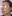 Augmentation rhinoplasty for a low/flat nasal bridge — Uri Plastic Surgery Clinic