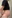 Abdominoplasty (tummy tuck) — Tangl Plastic Surgery Clinic