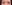 二重まぶた（自然癒着法） — イエロー美容外科クリニック