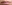 唇のヒアルロン酸注入（リップヒアルロン酸） — デザイン美容外科クリニック