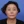 印第安纹玻尿酸填充 — 术后 (60天) · La Bom医美诊所