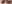 二重まぶた（自然癒着法） — ルホ美容外科クリニック