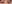 眼瞼下垂手術（目つき矯正） — プロミス美容外科クリニック