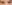 眼瞼下垂手術（目つき矯正） — ルホ美容外科クリニック