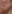 顔の脂肪吸引 — バイブ美容外科クリニック