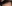 額縮小術（生え際下げ・ヘアライン下降術） — ザフィックス美容外科クリニック