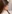 鼻骨骨切り（鼻骨骨切り幅寄せ術） — アーバン美容外科クリニック