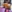 唇のヒアルロン酸注入（リップヒアルロン酸） — ドレス美容外科クリニック