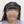 Scalp hair transplant — before (2days) · Vance Mosae Clinic