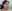 Full-face fat grafting (autologous fat transfer) — Mind Plastic Surgery