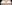 裏ハムラ法（経結膜的眼窩脂肪移動術） — プレジャー美容外科クリニック