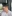 Nasal Tip Plasty with Autologous Cartilage — Uri Plastic Surgery Clinic