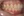 MTA orthodontics (Mini-Tube Appliance partial braces) — after (177days) · Lucent Dental Clinic