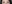 二重まぶた（自然癒着法） — プロミス美容外科クリニック