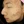 Laser Genesis (Cutera; long-pulsed 1064 nm Nd:YAG non-ablative rejuvenation) — before (35days) · K-Tox Clinic - Incheon Guwol Branch