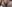 豊胸（脂肪注入） — ソウルアイ美容外科クリニック
