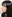 鼻尖形成術（自家軟骨移植） — ハイエンド美容外科クリニック
