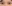 二重まぶた（自然癒着法） — ユーキャンビー美容外科クリニック