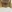 Double chin liposuction (submental liposuction) — Planner Plastic Surgery Clinic