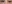 切開法（全切開法二重術） — オロ美容外科クリニック