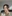 Nasal Tip Plasty with Autologous Cartilage — Tianna Plastic Surgery Clinic