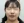 ฟิลเลอร์ติ่งหู (เสริมติ่งหู / หูมงคล) — หลังทำ · คลินิกยูพิค สาขาซองโด