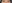 Lower Eyelid Fat Repositioning (transconjunctival) — Pleasure Plastic Surgery Clinic