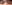 二重まぶた（自然癒着法） — ネイチャーオン美容外科クリニック