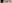 二重まぶた（自然癒着法） — プロミス美容外科クリニック