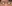 裏ハムラ法（経結膜的眼窩脂肪移動術） — プレジャー美容外科クリニック
