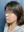 สลายไขมันใบหน้าด้วยเลเซอร์ (AccuSculpt) — ก่อนทำ (7วัน) · ยูไลน์คลินิก