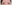 二重まぶた（自然癒着法） — プロミス美容外科クリニック