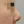 ผ่าตัดแก้ไขภาวะลิ้นจมูกตีบ/ยุบ (Nasal valve stenosis) — ก่อนทำ (30วัน) · Jindam Plastic Surgery Clinic