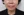 JUVGEN (autologous dermal regeneration / collagen-induction injection) — after (14days) · Saeroun Plastic Surgery