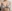 豊胸術（シリコンインプラント／人工乳腺） — バナナ美容外科クリニック