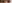 二重まぶた（自然癒着法） — フルルン美容外科クリニック