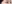 切開法（全切開法二重術） — IK美容外科クリニック