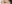 切開法（全切開法二重術） — IK美容外科クリニック