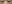 裏ハムラ法（経結膜的眼窩脂肪移動術） — プレジャー美容外科クリニック