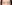 裏ハムラ法（経結膜的眼窩脂肪移動術） — プレジャー美容外科クリニック