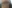 二重あごの脂肪吸引（顎下脂肪吸引） — ドクター・ジョン リバンクリニック