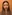 Revision facial contouring surgery (secondary facial bone surgery) — WHY Oral and Maxillofacial Surgery & Dental Clinic