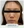 ฉีดไขมันตัวเองทั้งใบหน้า (ศัลยกรรมเติมไขมันใบหน้า) — ก่อนทำ (15วัน) · คลินิกเซรอน