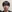 鼻尖形成術（自家軟骨移植） — ワンダフル美容外科クリニック