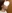 二重あごの脂肪吸引（顎下脂肪吸引） — セギム美容外科クリニック