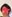 jaw angle reduction (mandibular angle osteotomy) — Saegim Plastic Surgery Clinic