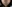 Facial liposuction — Jerim Plastic Surgery Clinic