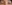 上眼瞼のたるみ取り（上眼瞼リフト・眉下切開） — ダシピウム美容外科クリニック