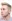 Lateral canthoplasty (outer corner opening) — Eight Plastic Surgery Clinic
